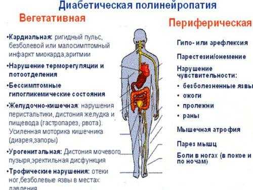 Полинейропатия верхних и нижних конечностей: симптомы и лечение