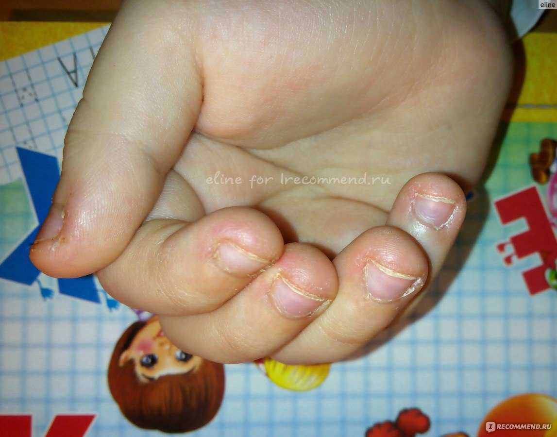 Как отучить ребенка грызть ногти на руках? - развитие ребенка