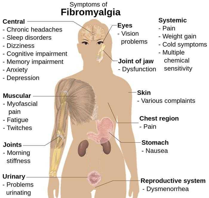 Фибромиалгия – приговор на всю жизнь?