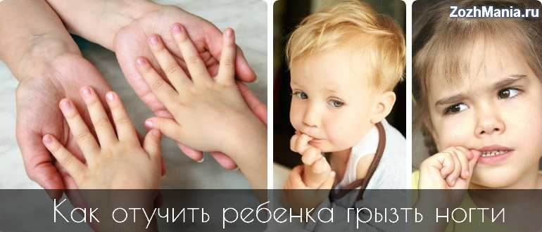Е. комаровский: ребенок грызет ногти - что делать, как отучить грызть