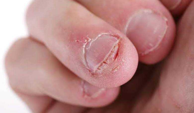 Ребенок грызет ногти: что делать? 5 способов отучить