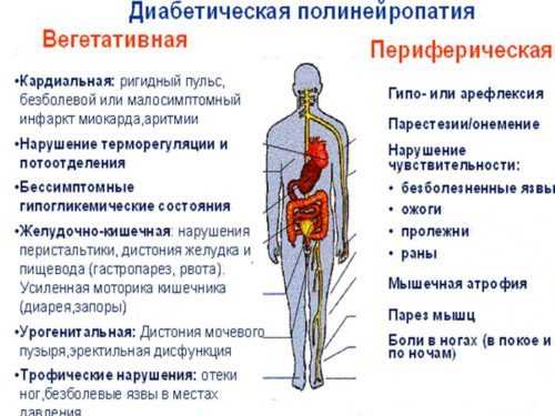 Полинейропатия нижних конечностей: симптомы и признаки, прогноз. лечение полинейропатии в москве