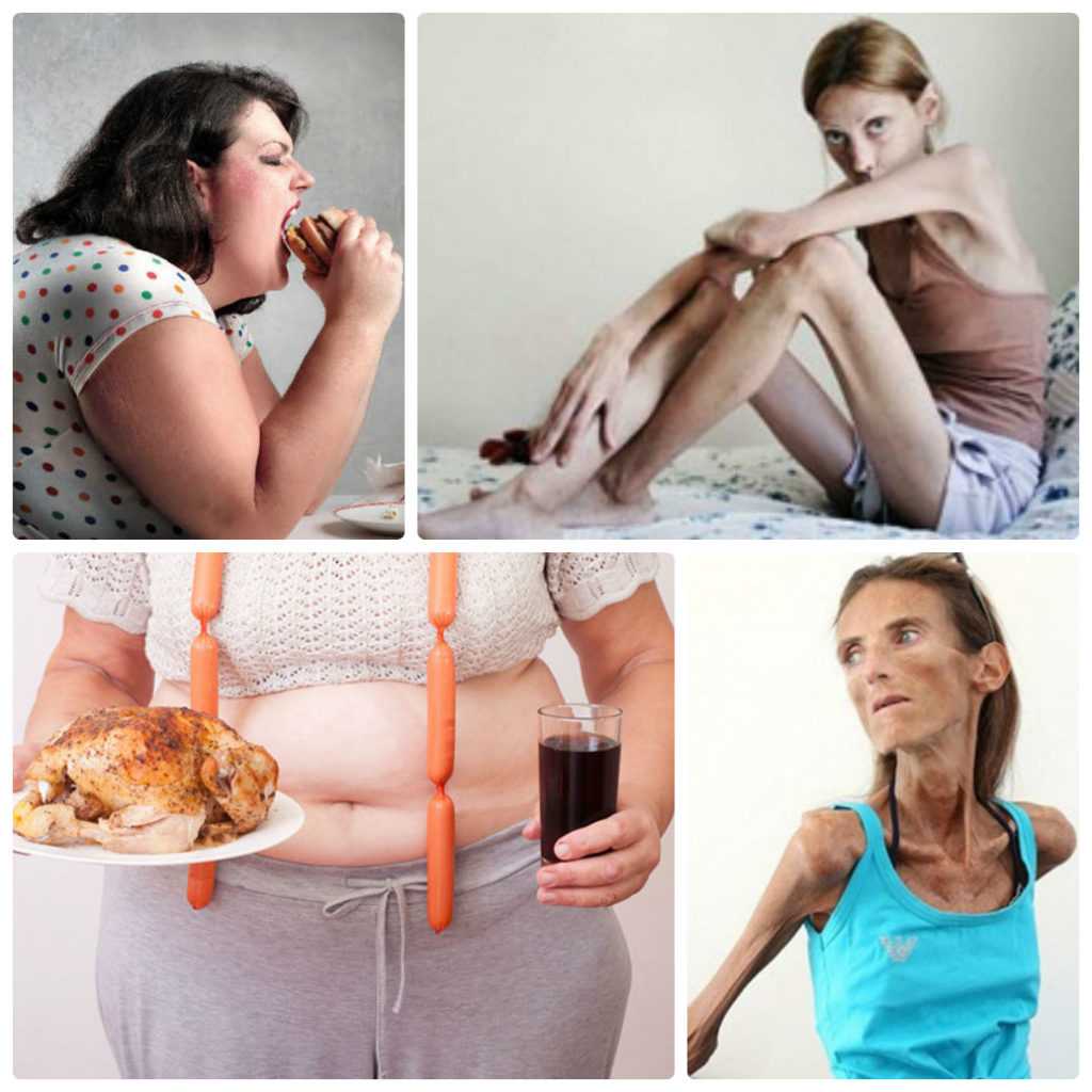 Психологические особенности женщин с нарушением пищевого поведения