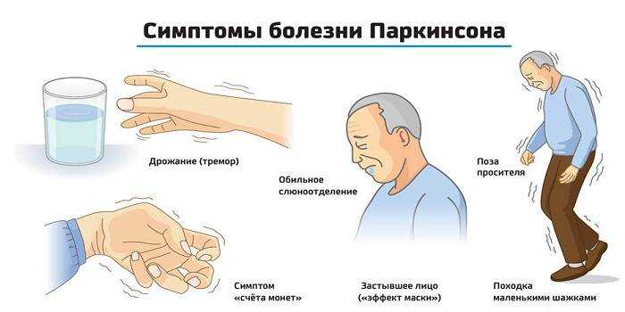 Тремор рук или почему трясутся руки: причины и лечение