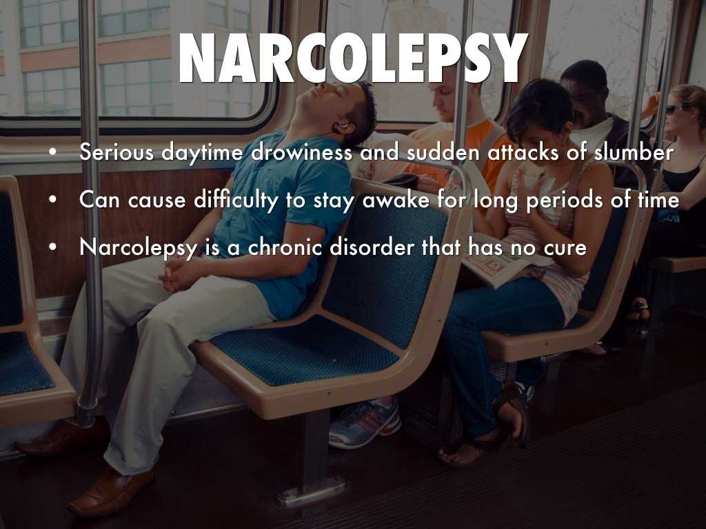 Нарколепсия: причины, симптомы, диагностика и лечение