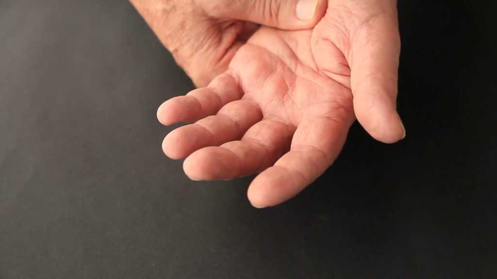 Тремор рук: причины и лечение в домашних условиях