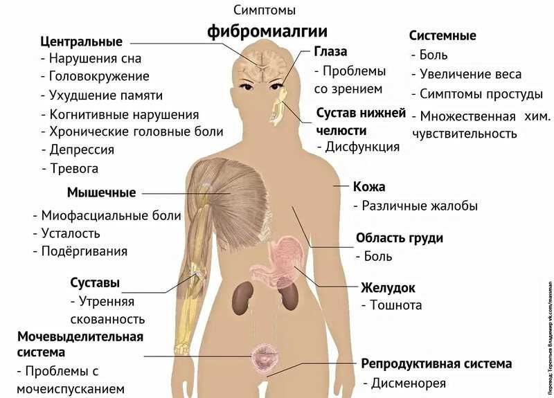 Что такое фибромиалгия мышц, симптомы, причины... - zdorsustav.ru
