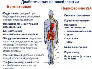 Диабетическая полинейропатия нижних конечностей - что это, лечение