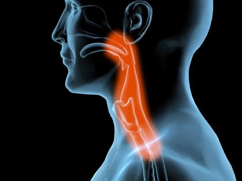 Невроз глотки: может ли горло болеть от нервов?