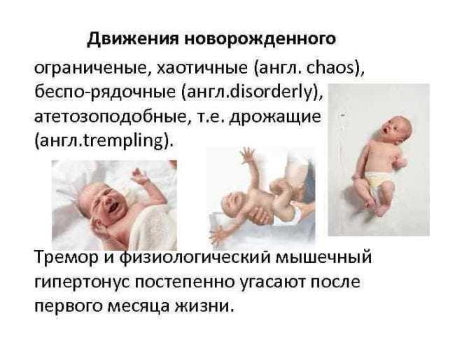 У новорожденного трясется подбородок: когда тремор – это норма, а когда – патология